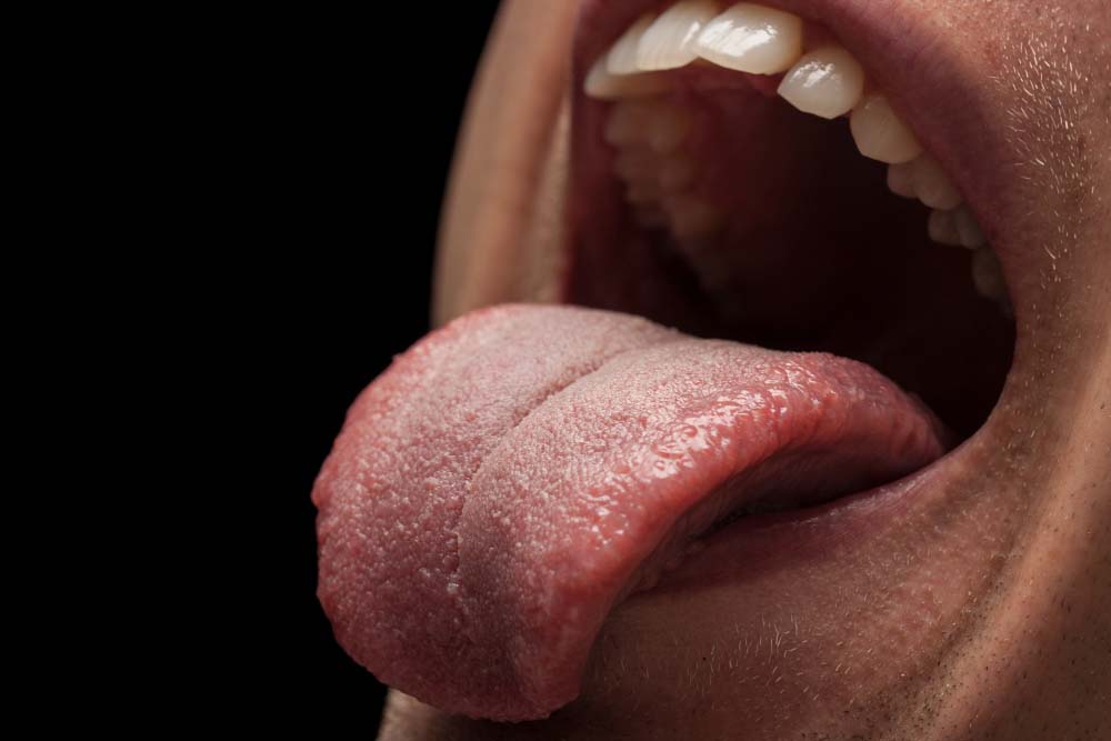 Sobrevivente de câncer na língua causado por HPV alerta população masculina sobre riscos da doença